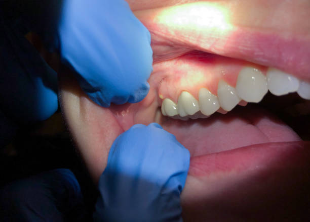 Best Holiday Emergency Dentist in Hartley, CA